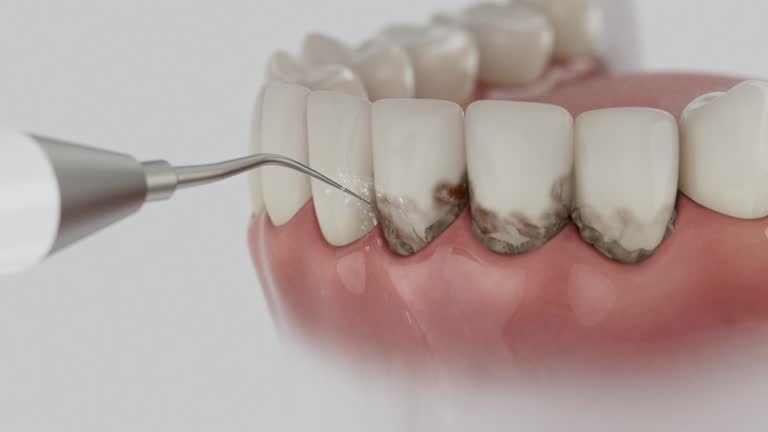 Reliable Dental contractor in Kent, OH by Dentist Open Now